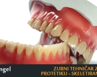 Zubni tehnicar za mobilnu protetiku skeletirana proteza beograd